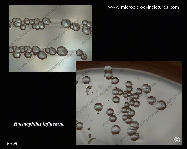 h.influenzae colonies